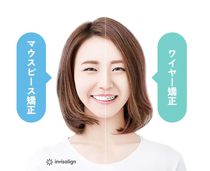 治療の比較