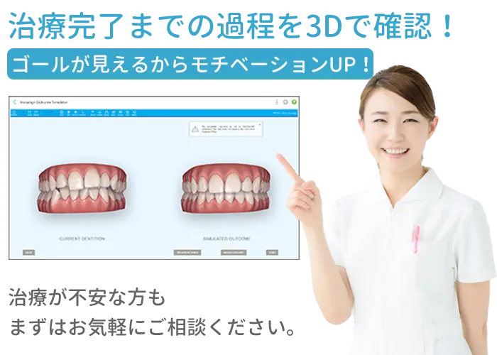 アウトカムシミュレーター